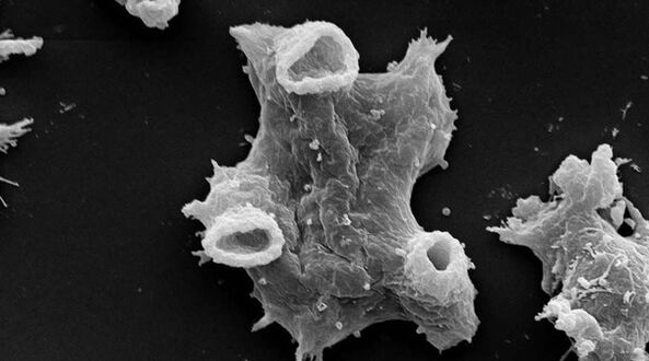 Negleria fowlera — адам өмүрүнө коркунучтуу протозой паразит. 