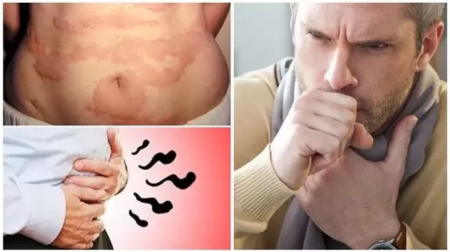 Аллергия, жөтөл жана шишик организмге курттар тарабынан зыян келтирүүнүн белгиси